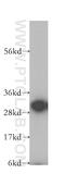 F-actin-capping protein subunit alpha-1 antibody, 11806-1-AP, Proteintech Group, Western Blot image 