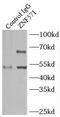 Zinc Finger Protein 571 antibody, FNab09715, FineTest, Immunoprecipitation image 