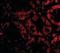 Metalloreductase STEAP2 antibody, NB100-80829, Novus Biologicals, Immunofluorescence image 