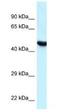 Hyaluronidase-3 antibody, NBP1-79911, Novus Biologicals, Western Blot image 