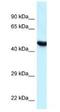 Hyaluronidase 3 antibody, NBP1-79911, Novus Biologicals, Western Blot image 