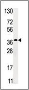 Ribokinase antibody, AP13842PU-N, Origene, Western Blot image 