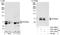 Protein Phosphatase 2 Regulatory Subunit B'Delta antibody, A301-100A, Bethyl Labs, Western Blot image 