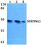 Serpin Family A Member 3 antibody, A02312, Boster Biological Technology, Western Blot image 