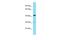 CMT1A Duplicated Region Transcript 15 Like 2 antibody, A19605, Boster Biological Technology, Western Blot image 