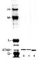 Peripherin antibody, LS-C204574, Lifespan Biosciences, Western Blot image 