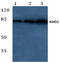 Adducin 2 antibody, AP20545PU-N, Origene, Western Blot image 