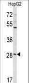 Coiled-Coil Domain Containing 85B antibody, LS-C167419, Lifespan Biosciences, Western Blot image 