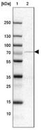 Alpha-1,3-Mannosyl-Glycoprotein 4-Beta-N-Acetylglucosaminyltransferase A antibody, NBP1-81809, Novus Biologicals, Western Blot image 