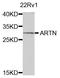 Lysine Demethylase 5B antibody, orb373753, Biorbyt, Western Blot image 