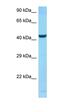 SPARC (Osteonectin), Cwcv And Kazal Like Domains Proteoglycan 2 antibody, orb326417, Biorbyt, Western Blot image 