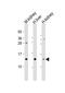 Mature T Cell Proliferation 1 antibody, PA5-49474, Invitrogen Antibodies, Western Blot image 