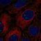 Clustered Mitochondria Homolog antibody, NBP2-54967, Novus Biologicals, Immunofluorescence image 