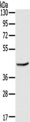 MAGE Family Member B3 antibody, TA351372, Origene, Western Blot image 