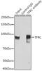 Transferrin Receptor antibody, GTX33080, GeneTex, Immunoprecipitation image 