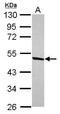 DEAD-Box Helicase 47 antibody, GTX120497, GeneTex, Western Blot image 