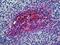 Complement C3d Receptor 2 antibody, LS-B5145, Lifespan Biosciences, Immunohistochemistry paraffin image 