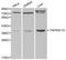 TNF Receptor Superfamily Member 1A antibody, LS-C192275, Lifespan Biosciences, Western Blot image 