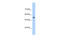 Solute Carrier Family 13 Member 3 antibody, 29-575, ProSci, Enzyme Linked Immunosorbent Assay image 