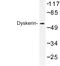 Dyskerin Pseudouridine Synthase 1 antibody, LS-C176706, Lifespan Biosciences, Western Blot image 