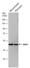 4-Aminobutyrate Aminotransferase antibody, GTX133344, GeneTex, Western Blot image 