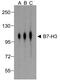CD276 Molecule antibody, TA355139, Origene, Western Blot image 