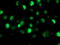 SAM And HD Domain Containing Deoxynucleoside Triphosphate Triphosphohydrolase 1 antibody, M00592-1, Boster Biological Technology, Immunofluorescence image 