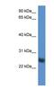 Src Like Adaptor 2 antibody, NBP1-79830, Novus Biologicals, Western Blot image 