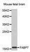 Fatty Acid Binding Protein 7 antibody, PA5-76677, Invitrogen Antibodies, Western Blot image 