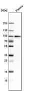 Complement C1s antibody, HPA018852, Atlas Antibodies, Western Blot image 