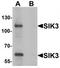 SIK Family Kinase 3 antibody, TA319854, Origene, Western Blot image 