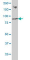 Ring Finger Protein 139 antibody, LS-C133685, Lifespan Biosciences, Western Blot image 
