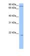 Actin Related Protein 2/3 Complex Subunit 3 antibody, orb330659, Biorbyt, Western Blot image 