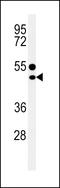 T-cell surface glycoprotein CD1e, membrane-associated antibody, 64-200, ProSci, Western Blot image 