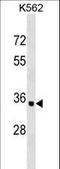 Olfactory Receptor Family 10 Subfamily AD Member 1 antibody, LS-C158446, Lifespan Biosciences, Western Blot image 