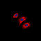 Collagen Type III Alpha 1 Chain antibody, LS-C352027, Lifespan Biosciences, Immunofluorescence image 