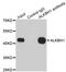 AlkB Homolog 1, Histone H2A Dioxygenase antibody, LS-C334580, Lifespan Biosciences, Immunoprecipitation image 