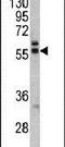 Preferentially Expressed Antigen In Melanoma antibody, PA5-13679, Invitrogen Antibodies, Western Blot image 