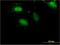 Zinc Finger Protein 598 antibody, H00090850-M11, Novus Biologicals, Immunocytochemistry image 
