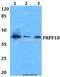 Pre-MRNA Processing Factor 18 antibody, A13674-1, Boster Biological Technology, Western Blot image 
