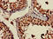 Phosphoribosyl Pyrophosphate Synthetase 2 antibody, orb52919, Biorbyt, Immunohistochemistry paraffin image 