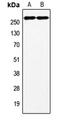 Coagulation Factor VIII antibody, MBS820685, MyBioSource, Western Blot image 