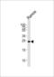 Growth Factor Receptor Bound Protein 2 antibody, 62-216, ProSci, Western Blot image 