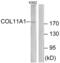 Collagen Type XI Alpha 1 Chain antibody, abx013958, Abbexa, Western Blot image 