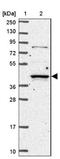 Ras association domain-containing protein 2 antibody, NBP2-13206, Novus Biologicals, Western Blot image 