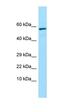 Trehalase antibody, orb326545, Biorbyt, Western Blot image 