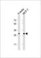 Olfactory Receptor Family 4 Subfamily M Member 2 antibody, 59-712, ProSci, Western Blot image 
