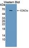 Cytokine Receptor Like Factor 1 antibody, LS-C373341, Lifespan Biosciences, Western Blot image 