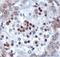 Teratocarcinoma-Derived Growth Factor 1 antibody, ab19917, Abcam, Immunohistochemistry paraffin image 