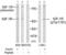 Insulin Like Growth Factor 1 Receptor antibody, PA5-37601, Invitrogen Antibodies, Western Blot image 